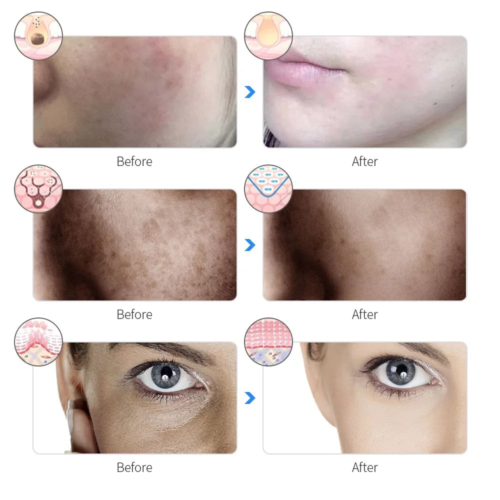LumiGlow™ 7-Color LED Facial Therapy Mask